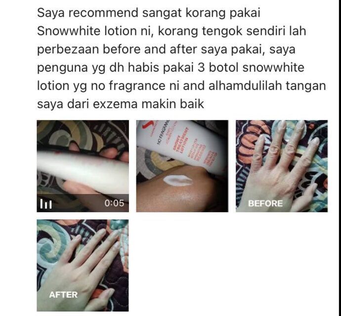 Sebelum Selepas